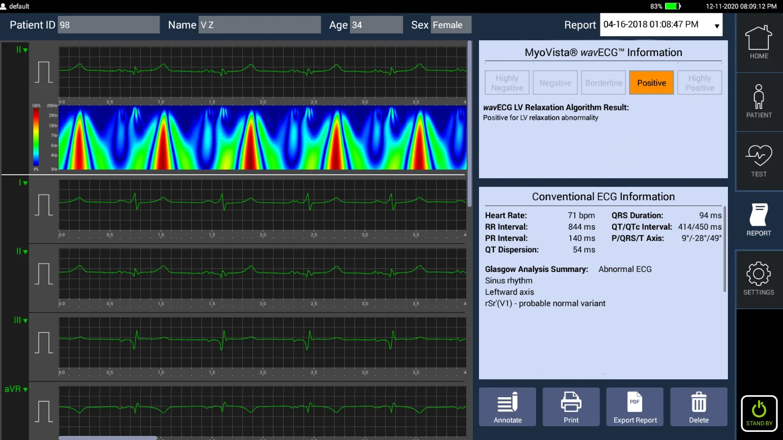 MyoVista® wavECG™ Device - Clinical-Grade ECG Acquisition